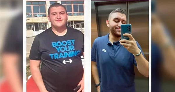 Vittaburn™ Customer